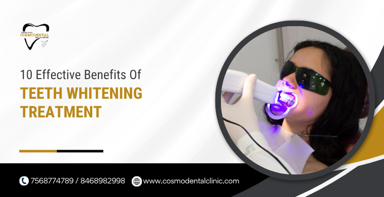 Teeth Whitening Treatment