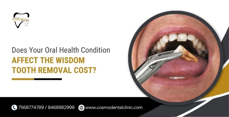 wisdom tooth removal cost in Wanowrie