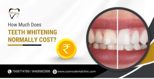 How Much Does Teeth Whitening Normally Cost?