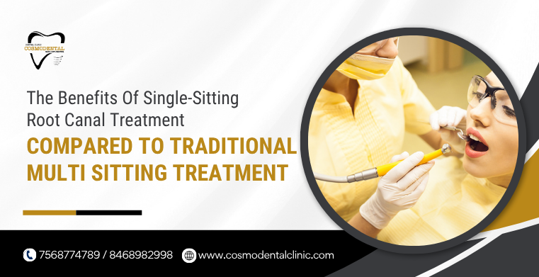 Single-Sitting Root Canal Treatment